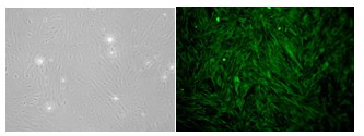 displays a valve interstitial cell (VIC) with a positive vimentin marker. Phase-contrast microscopy picture on the left, vimentin fluorescent labeling on the right.